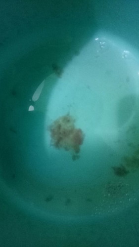 pasintabi po @ 35weeks