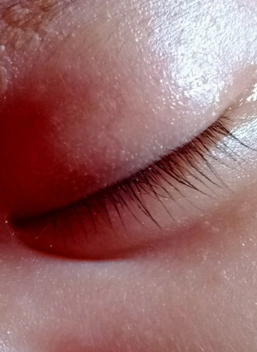 Eyes ni baby