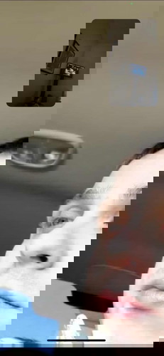 อัลตราซาวด์ครั้งที่2