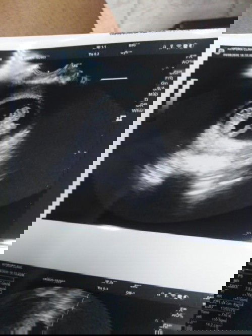 อยากรู้ว่าถ้าเป็นแบบนี้