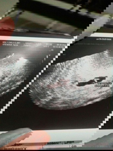 First Trimester