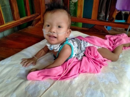 ขอกำลังใจหน่อยคะ อัพเดตอาการคะ น้องได้1ขวบแล้วคะ