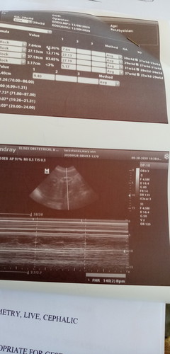 It's a BOY!