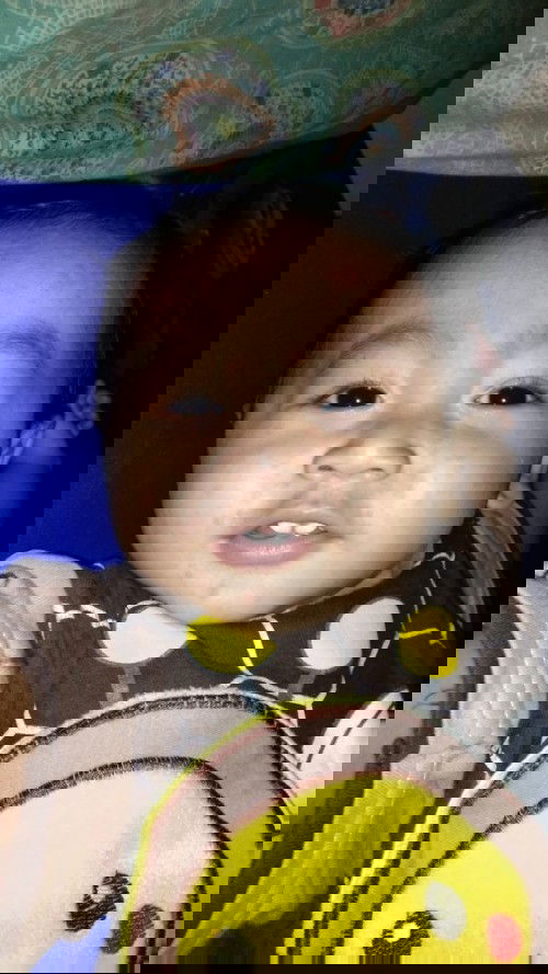 Bantu jawab..Campak atau bukan