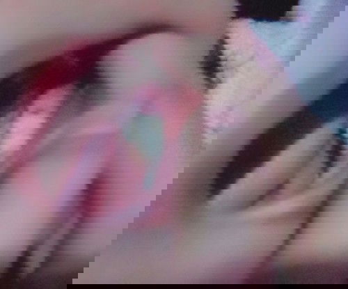 Gusi bengkak dan sakit