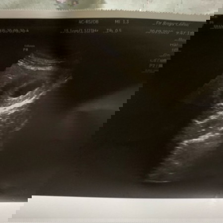 มีแม่ๆบ้านไหน คุณหมอเคยทักเป็นแบบนี้มั้ยค่ะ