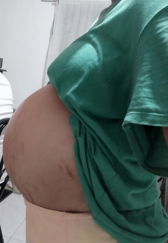36 weeks and 3 days