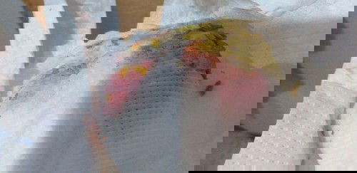 Breast feed baby stool