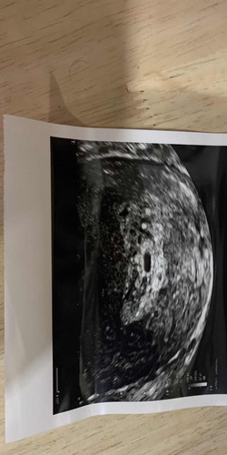 6w1d scan