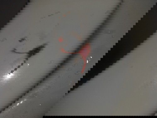 หมูกเลือด หลังคลอด.