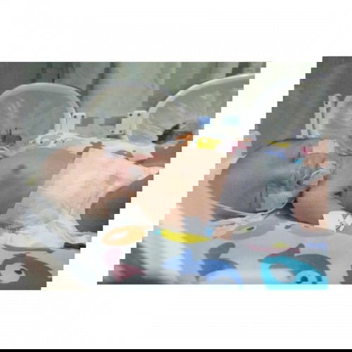 Ceritaku Pentingnya MengASIhi, Memberikan ASI untuk Bayi Kembarku yg Masuk NICU dan Cedera Bahu