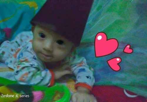 Kenapa anak saya suka kembung dan gumoh? dan kalau mau ada kebisa pasti demam