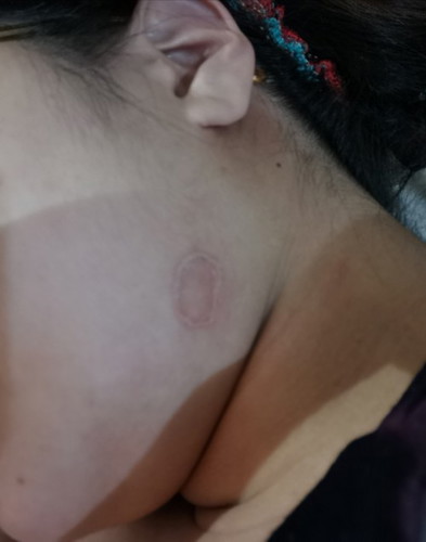 Ano po ito?
