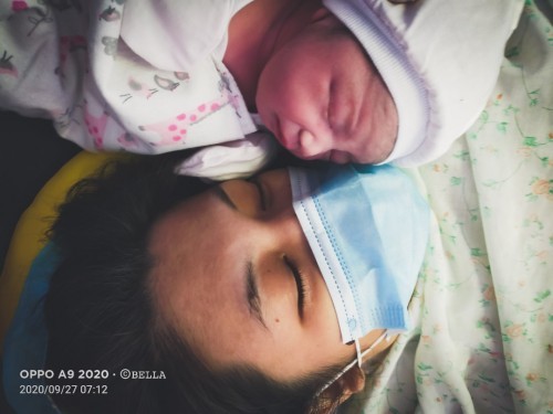 Unexpected CS delivery