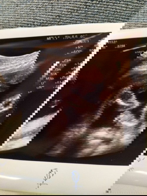 ชายหรือหญิง 👦👧