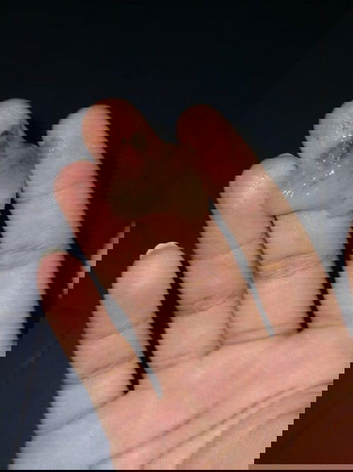 ต้องไปรพ.ไหม40+1วีค