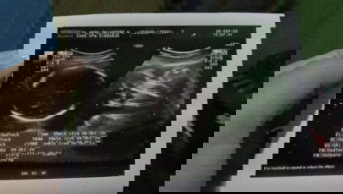 Usg Dokter Cuek bangettt