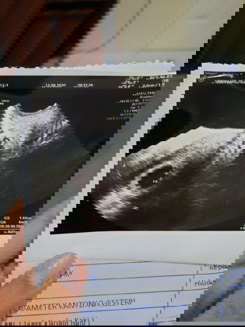 Saya belum usg lg dari 6 week ga apa" ya bun?