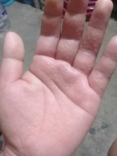 Butlig Butlig butlig Momhs anu kaya ito sa kamay ko sobrang kati ny