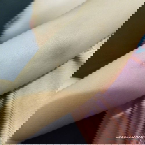 Bekas Gigitan nyamuk