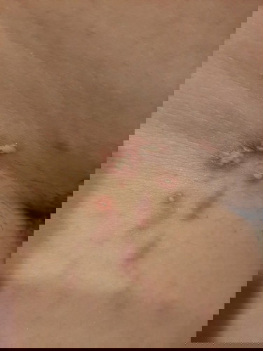 เป็นแบบนี้ขณะตั้งครรภ์สามารถใช้ยาอะไรได้บ้างคะ