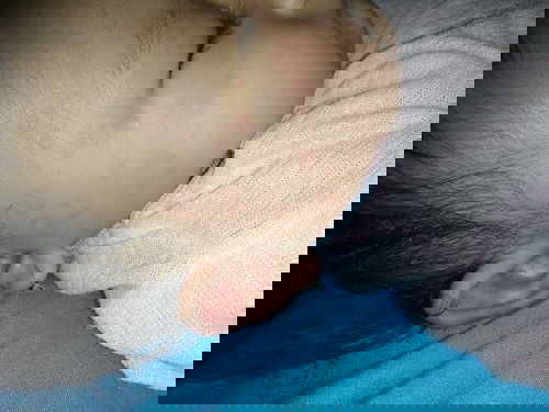 Bentol2 di seluruh badan