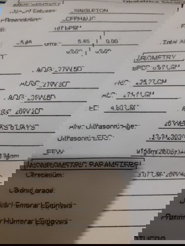 Ultrasound @ 28 weeks