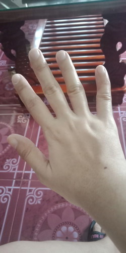 Good pm po... Kasama po ba sa symptoms ng pregnancy ang pamamanhid at pamamanas ng kamay? 20w3d preg