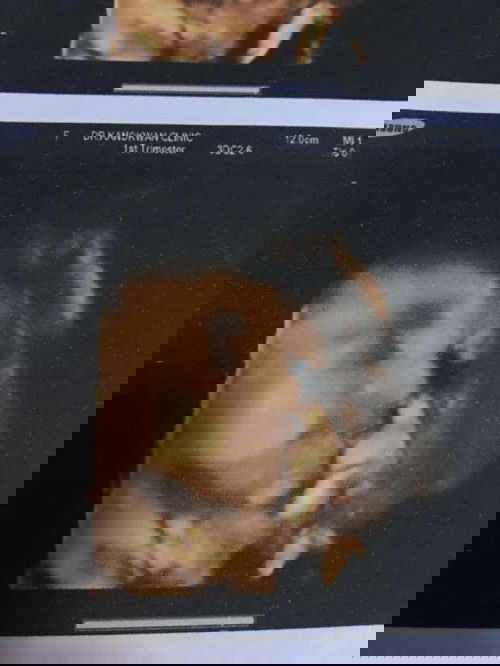 แม่ๆตอนนี้กี่วีคกันแล้วค่ะ