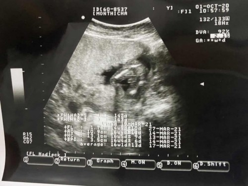 ช่วยวิเคราะห์หน่อยค่ะ ผู้ชายหรือผู้หญิง ☺️