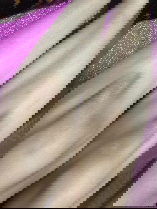 ada yg gatal-gatal di lutut selama hamil?