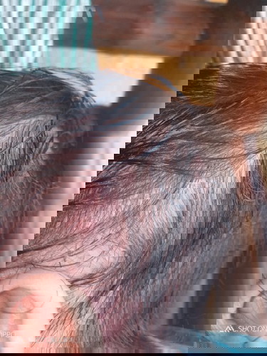 Hai po ask lo po sna if ano yun tumtubo sa ulo ni baby na bukol na namumula and nangangati po lagi,