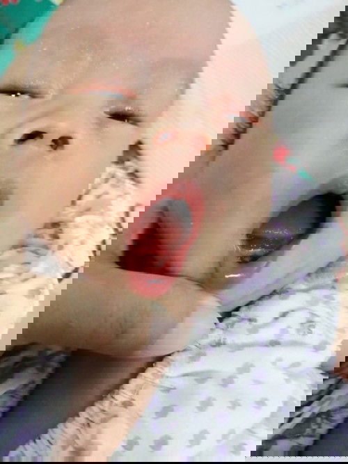 ลูกมีฟันขึ้นตั้งแต่เกิด