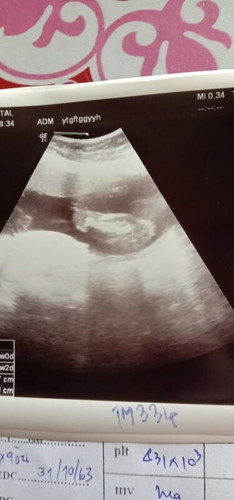 อยากรู้เพศ