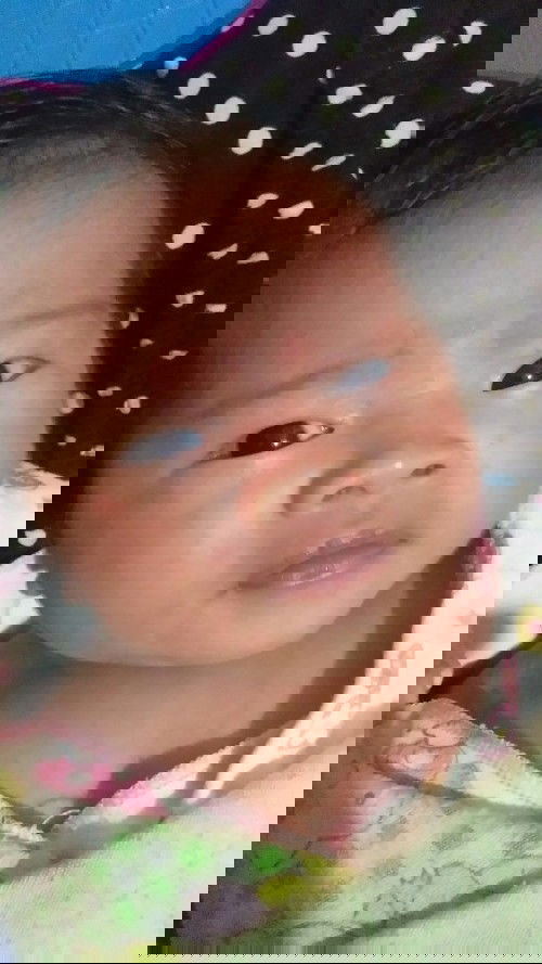 Muka baby bintik2 merah