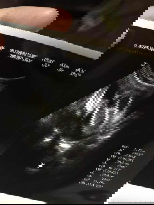 ช่วยดูให้หน่อยค่ะแม่ๆ ว่าเพศไหน