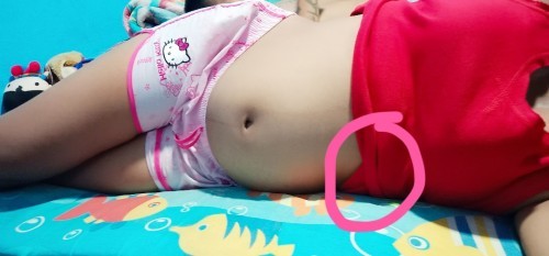 แม่บ้านไหนรู้สึกเจ็บชายโครงด้านซ้ายบ้าง....บ้านนี้ ตั้งครรภ์ได้ 37 วีค เจ็บมากแทบขยับตัวไม่ได้เลย