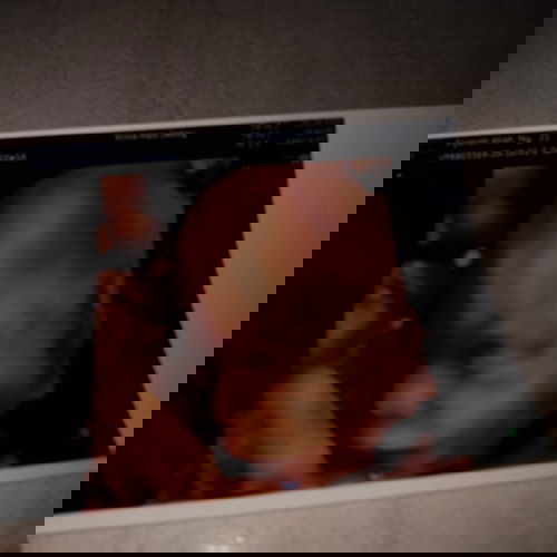 ari² menutup jalan lahir