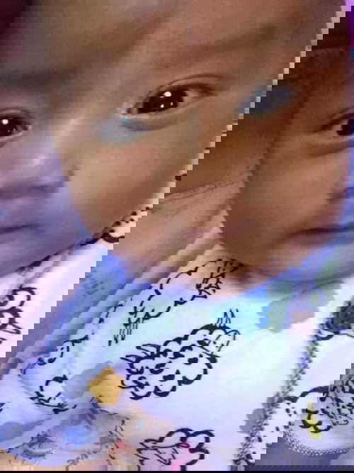 Bercak putih seperti panu