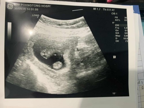 ขอดูทีมคุณแม่ลูกแฝดหน่อยค่ะ