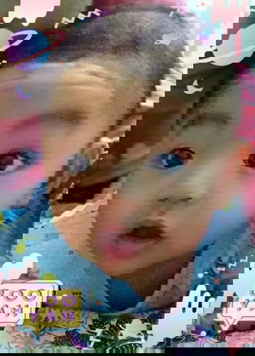 Menunggu Jadwal Operasi