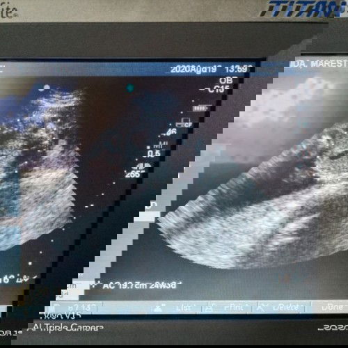 Pa help naman mg mommy