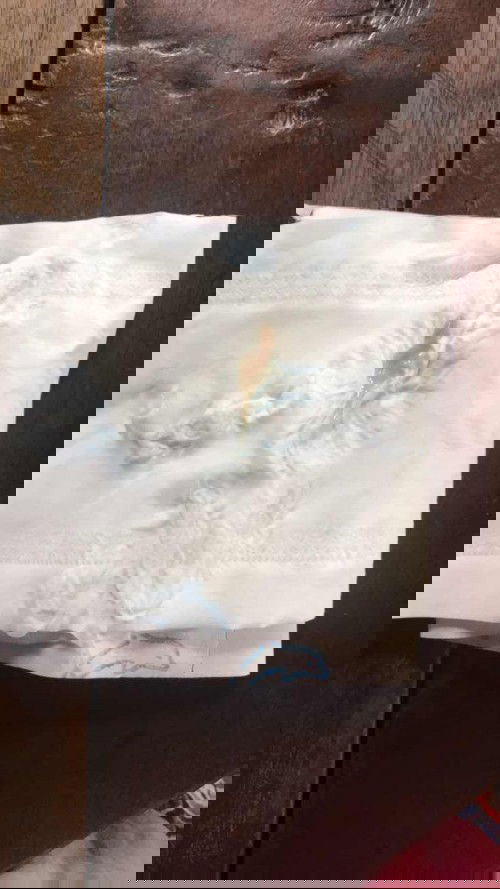 Chuyển dạ hay không