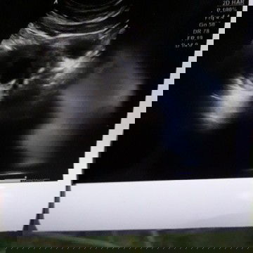 🤲🤲🤲🤲🤲🤲