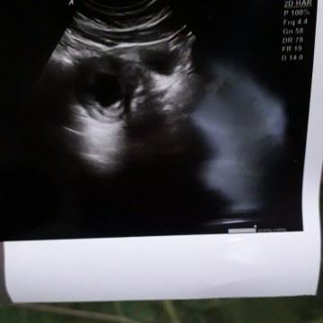 🤲🤲🤲🤲🤲🤲