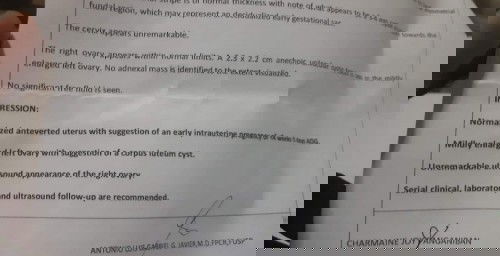 Pa help naman mga mommy