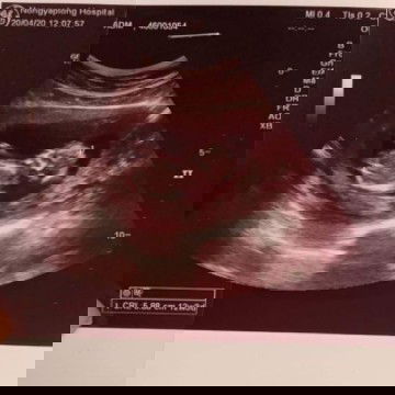 หญิงหรือชายคะ