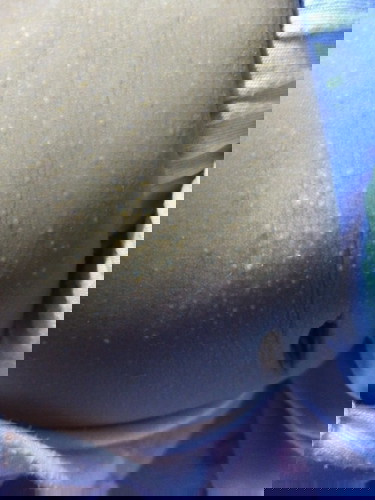 ลูกขึ้นผดค่ะปบบนี้เรียกว่าผดอะไรค่ะเป็นมาจะสองอามิตแล้วค่ะ