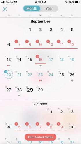 Possibility of being pregnant