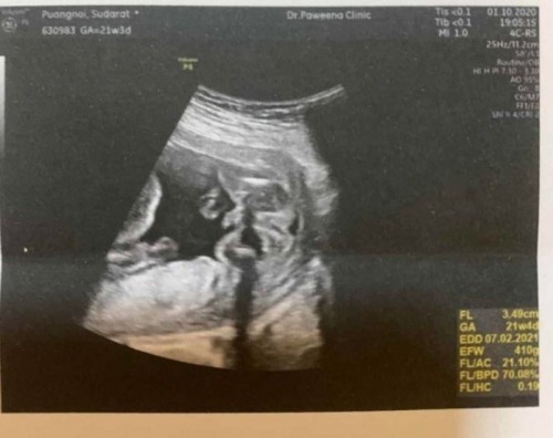 แบบนี้ ช/ญ ค่ะ